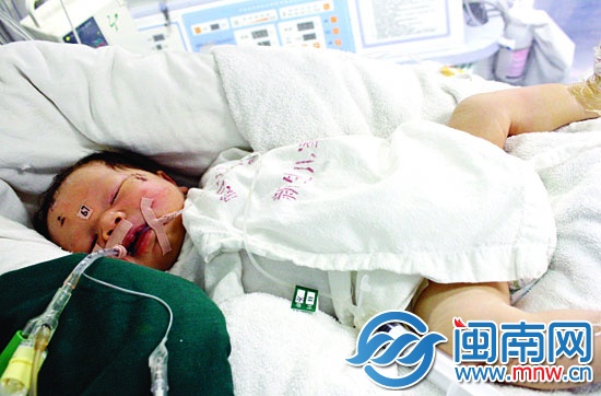 廈門(mén)奇跡寶寶趙平安病情加重
