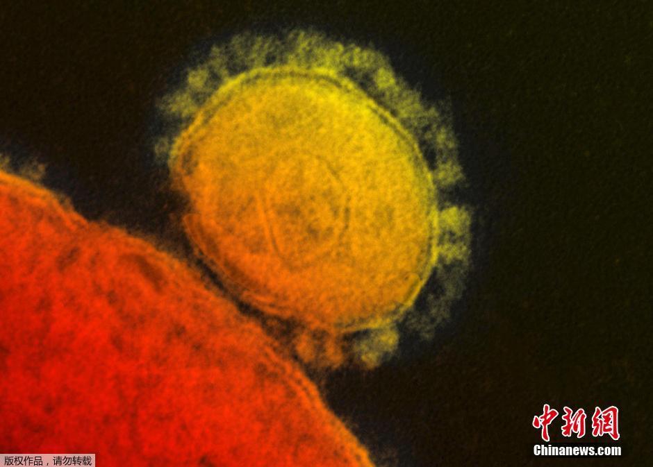 中東呼吸綜合征(MERS)