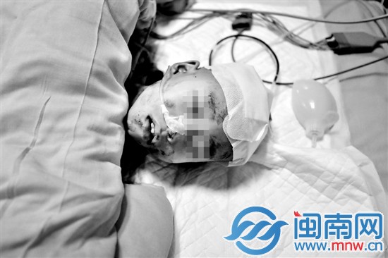 ICU里的小濤