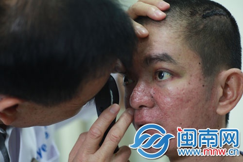醫(yī)生建議丁山做腦部CT，才能確定眼睛有何問題
