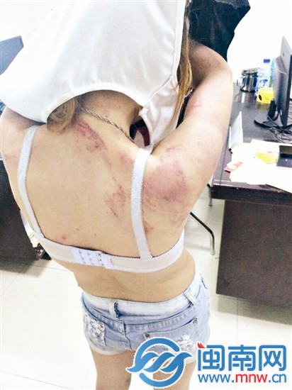 黃某在女警面前脫下衣服，身上傷痕累累
